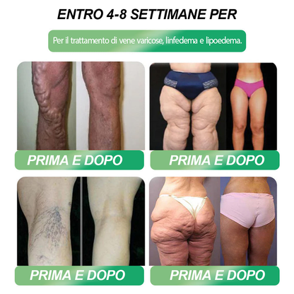 Sconto del 30% per un periodo limitato. Molti utenti scelgono di acquistare 6 scatole di HHVB® alla volta (fornitura di 60 giorni), in quanto ciò non solo stabilizza i risultati, ma offre anche un'offerta combinata di grande valore! 👍