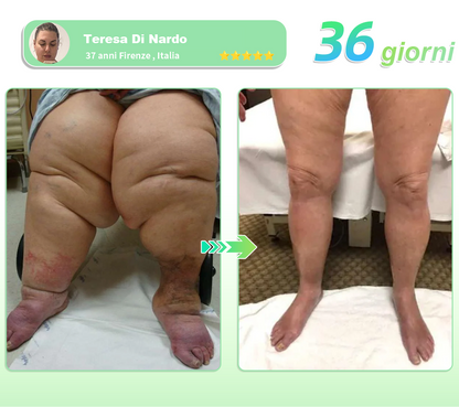 Sconto del 30% per un periodo limitato. Molti utenti scelgono di acquistare 6 scatole di HHVB® alla volta (fornitura di 60 giorni), in quanto ciò non solo stabilizza i risultati, ma offre anche un'offerta combinata di grande valore! 👍